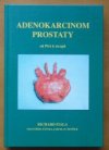 Adenokarcinom prostaty