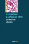 Neinvazivní karcinomy prsu