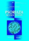 Psoriáza