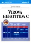 Virová hepatitida C