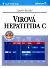 Virová hepatitida C