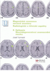 Magnetická rezonance nervové soustavy