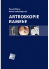 Artroskopie ramene