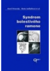 Syndrom bolestivého ramene