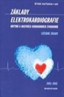 Základy elektrokardiografie arytmií a akutních koronárních syndromů