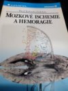 Mozkové ischemie a hemoragie